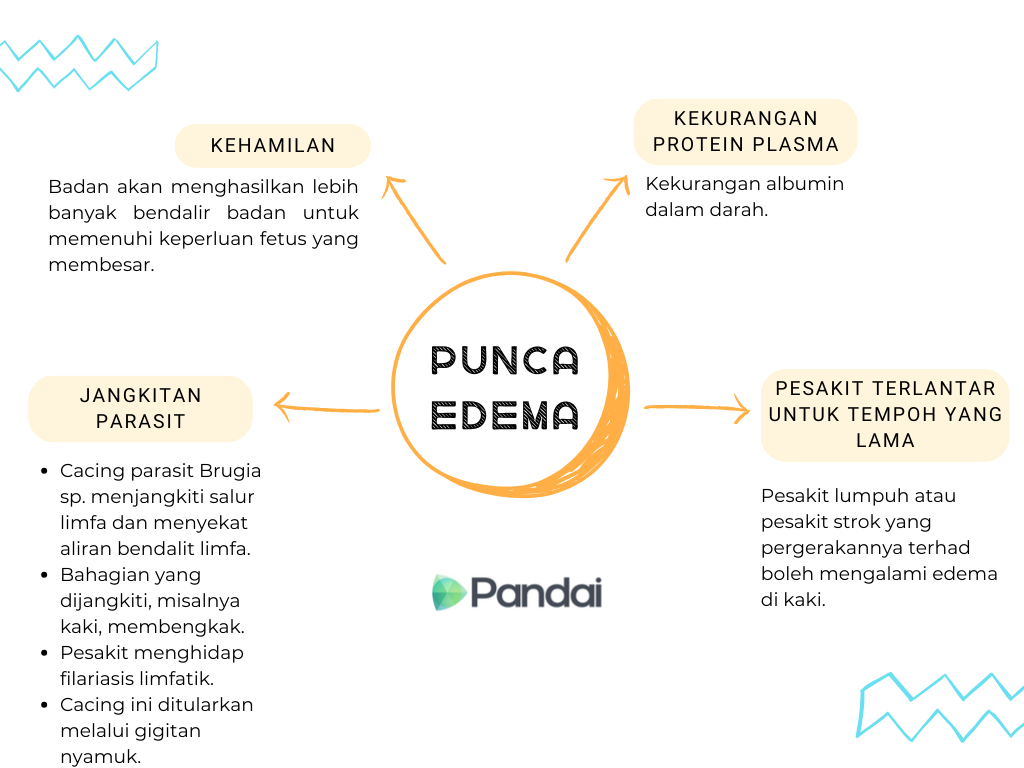 Imej ini menunjukkan satu infografik mengenai "Punca-punca Edema". Terdapat empat punca utama yang diterangkan dalam infografik ini: 1. Kehamilan (Pregnancy): Badan akan menghasilkan lebih banyak cecair badan untuk memenuhi keperluan janin yang sedang membesar. 2. Kekurangan Protein Plasma (Deficiency of Protein Plasma): Kekurangan albumin dalam darah. 3. Pesakit Terlantar Untuk Tempoh Yang Lama (Bedridden Patients for Long Periods): Pesakit yang lumpuh atau strok dengan mobiliti terhad boleh mengalami edema pada kaki. 4. Jangkitan Parasit (Parasitic Infection): Cacing parasit